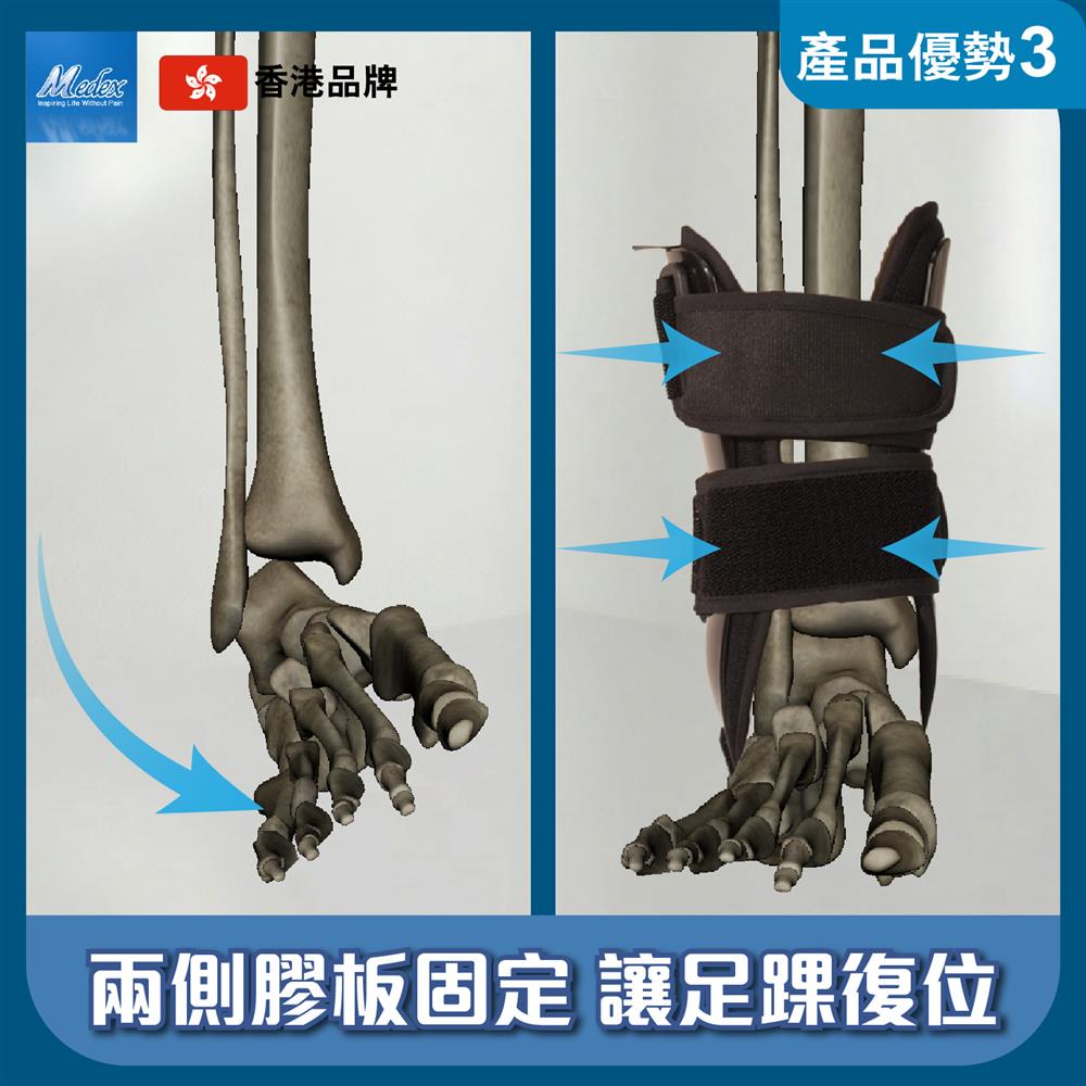 護踝