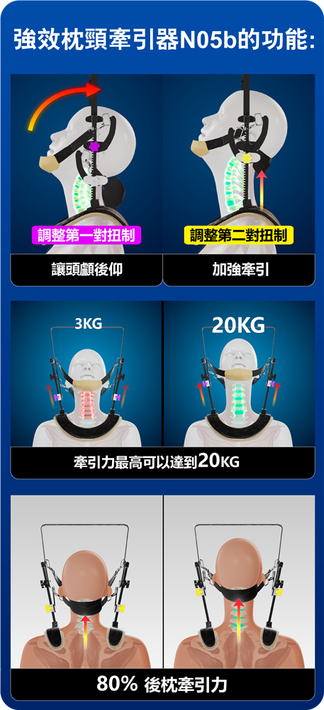 頸椎神經受壓